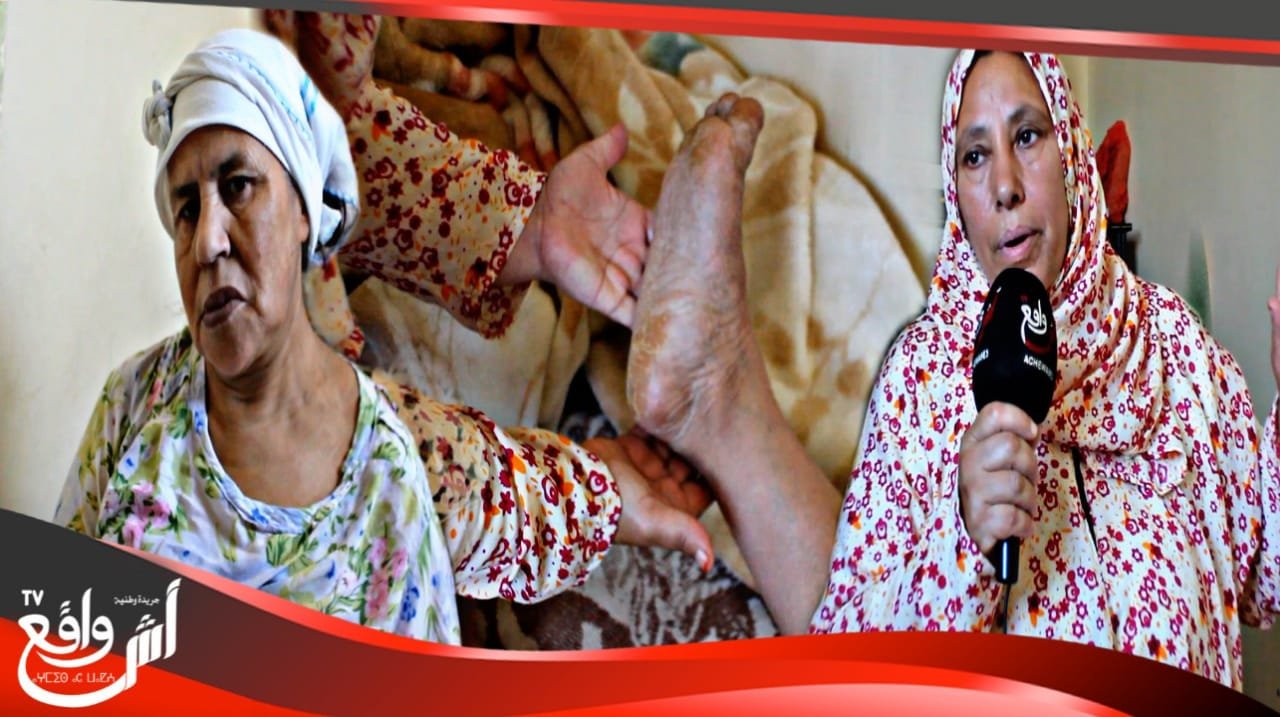 في زمن كورونا.. معاناة امرأة مسنة مع مرضها بالجديدة وتناشد المحسنين لمساعدتها...