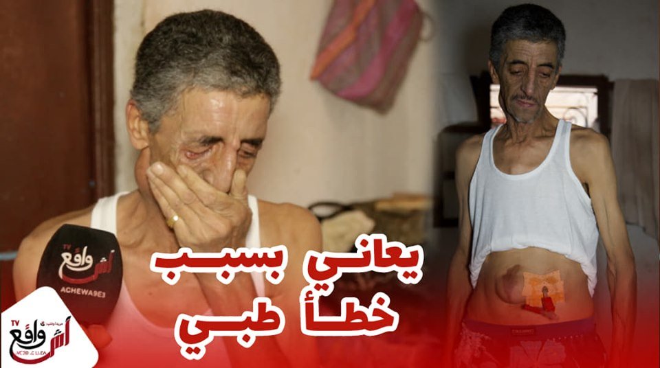 وا فينك أوزير صحة: خطأ طبي خطير..حياتي ضاعت لصقو ليا تِيُو في كرشي معرفت علاش شنو دور ديالو