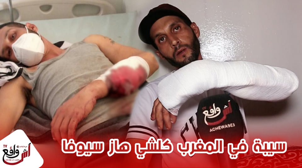 خطير هادشي كيخلع.. سيكيريتي ديال طرام شرملوه وقطعو ليه لعصب ديال يدو