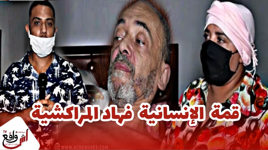 مراكشية: مشغلها فرنسي منساتش خيرو كانت خدامة عندو ودابا كتبيع البيض باش تشري ليه دوا