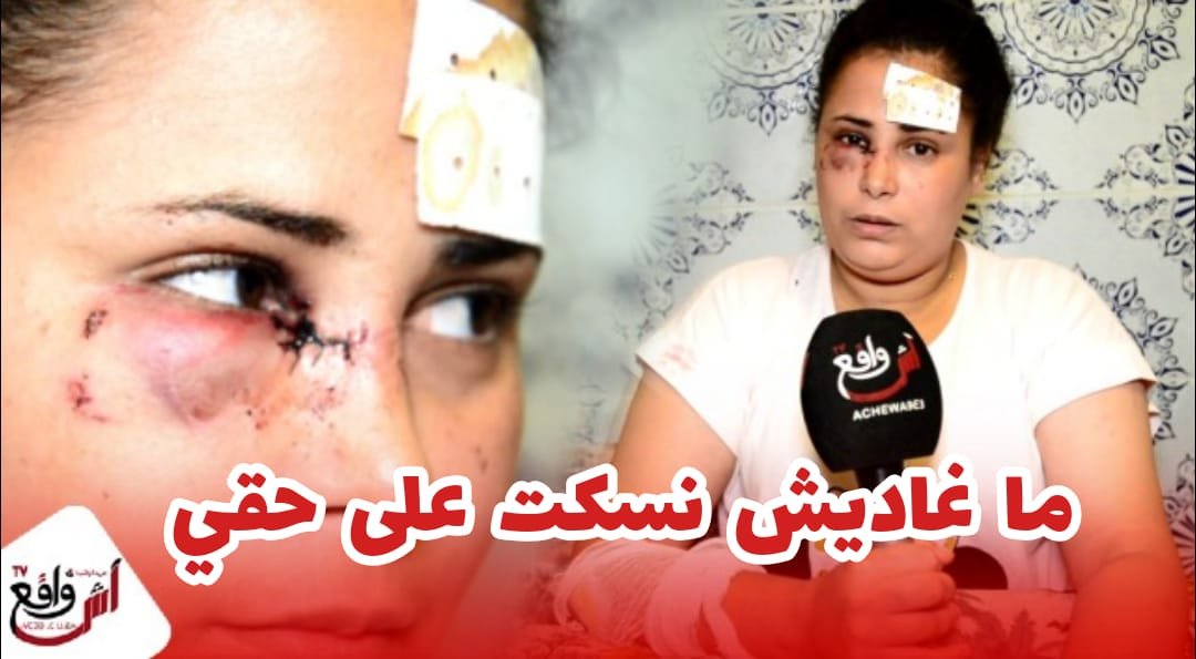 الفنانة نعمة العبدية تتعرض لاعتداء خطـ.ير وتصرخ "حقي منسكتش عليه لكنتي نتا رئيس مصلحة أنا فنانة"