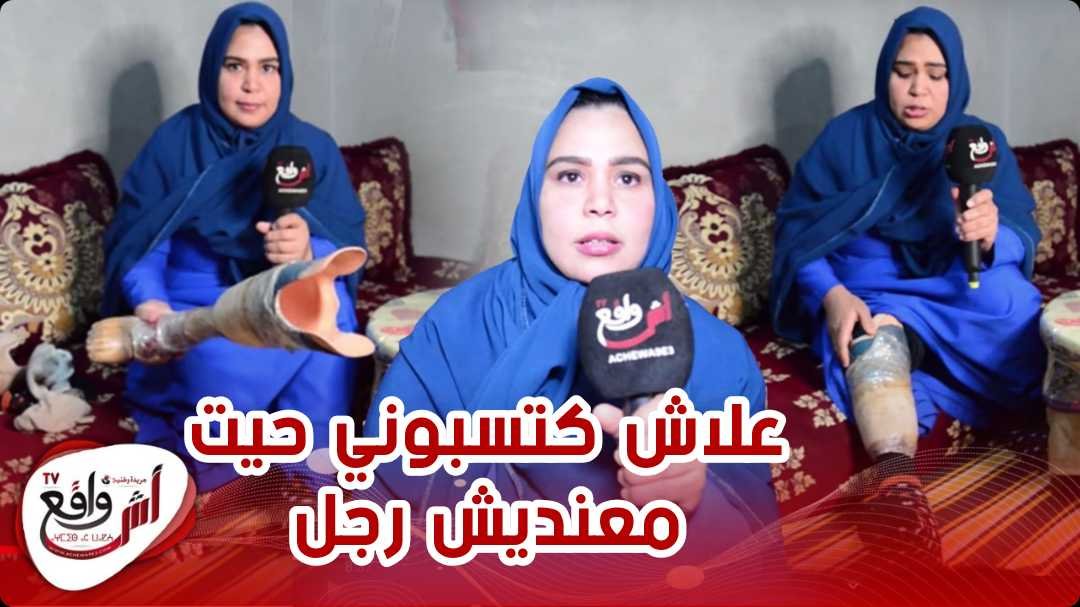 فاطمة الأشهب.. شابة من ذوي الاحتياجات الخاصة أنشأت قناة على اليوتيب من أجل اقتناء قدم اصطناعية