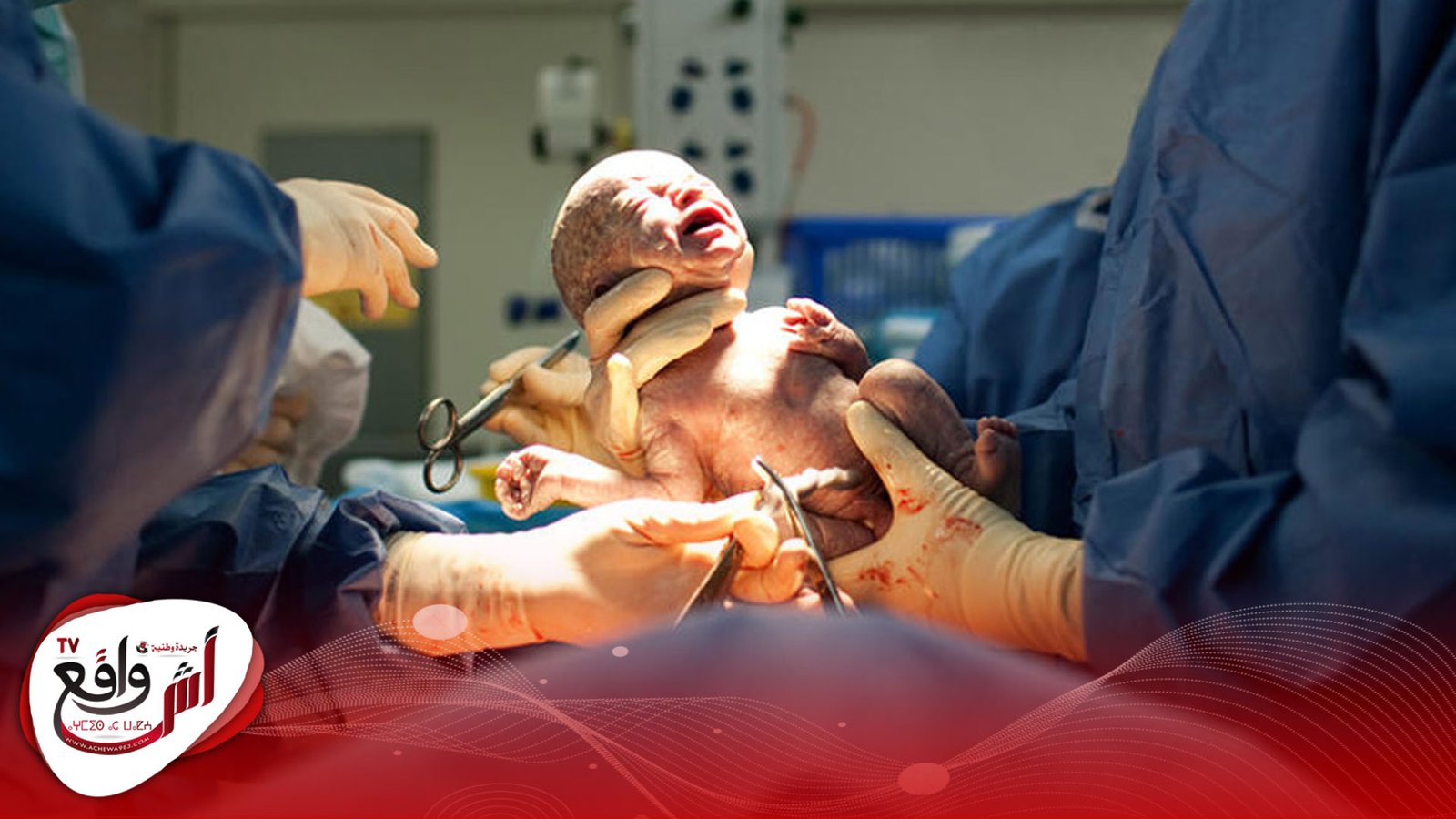 "ولادة تقليديّة" تتسبب في تمزًق الرحم ووفاة سيدة بميدلت اش واقع تيفي لقيت امرأة حامل حتفها جرّاء خضوعها لعملية ولادة تقليدية من طرف إحدى "القابلات" بدائرة "املشيل" التابعة لإقليم ميدلت، أمس الاثنين 11 يناير. وأصيبت الفقيدة خلال الولادة بنزيف داخلي ناتج عن تمزّق في الرحم بعد ولادتها في المنزل، نظراً لعدم خضوعها للعناية والمراقبة الطبية اللازمة لمثل هذه العمليات. وكشفت مصادر محليّة ان عملية الولادة التقليدية قد استنفدت طاقة المرأة الفقيدة بتجاوزها 16 ساعة بالنظر الى صعوبتها. ورغم وصول الطاقم الطبي والسلطات المحلية من أجل نقل السيدة الى المستشفى لمحاولة إنقاذها إلّا أنها توفيّت متأثرة بتمزّق الرحم قبل أن يتم نقلها خارج الدوّار. وكشف بلاغ لمندوبية الصحة بإقليم ميدلت، انها بعد تلقّي اخبارية تفيد وجود سيدة حامل في حالة صحيّة حرجة انتقلوا الى عين وتمّت محاولة نقلها الى المركز الصحي لكنها فارقت الحياة قبل الوصول إلى المركز. وشدّدت المندوبية على ضرورة تتبعّ أحوال الحمل في المراكز المختصّة لذلك وتفادي الولادة التقليدية التي تشكل خطورة على حياة النساء الحوامل.