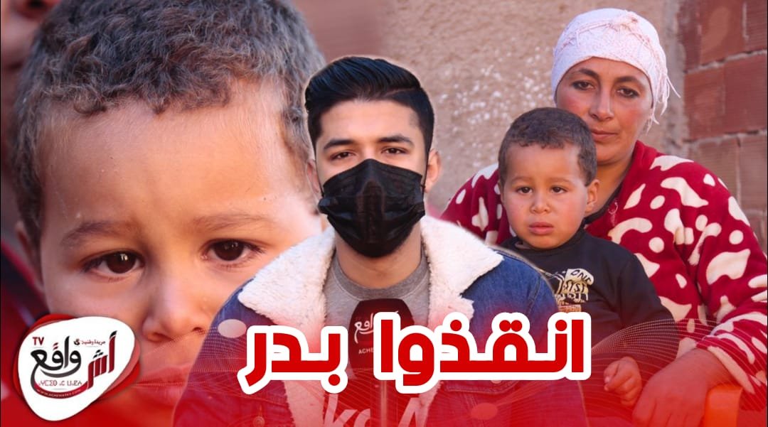 طفل بريء من المغرب العميق يحتاج عملية جراحية قبل ان يفقد بصره.. عاونونا باش نعتقوا بدر