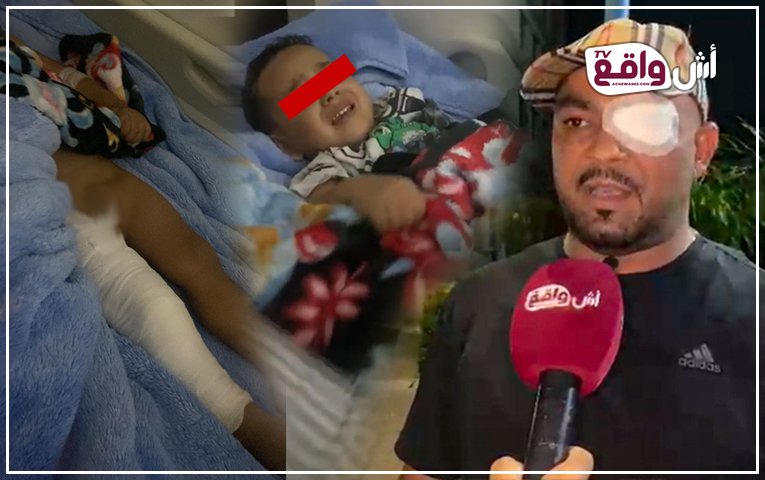 الجديدة.. تجار صحة أم أطباء؟ صرخة أب تهز الرأي العام: مصحة تطرد طفله مباشرة بعد العملية بحجة "عدم توفر الغرف"