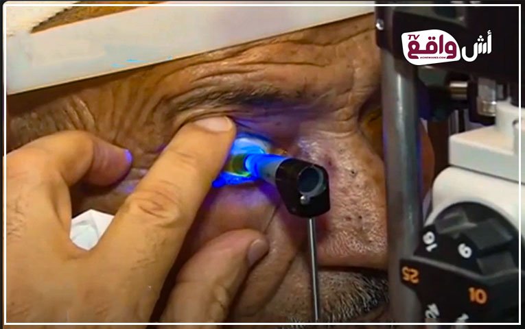 بصرك أملنا: حملة جراحية مجانية لمرضى الساد في الجديدة.. فرصة لا تُعوض لاستعادة وضوح الحياة!